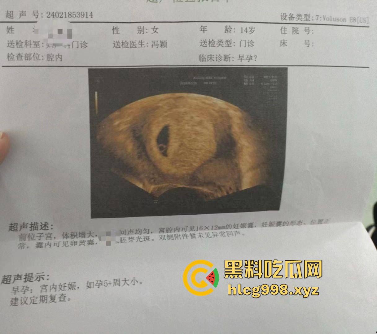 不到18岁小姑娘竟然怀孕！不带套灌满精液，爽完直接奔着5代同堂，真是绝了！-7