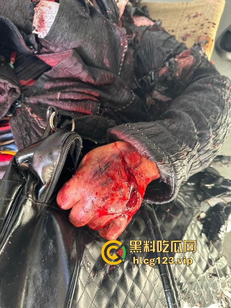 坐等看戏！伊朗对以色列的导弹袭击已结束 美准备好对抗伊朗？内含血腥无码画面 慎入！！！-7