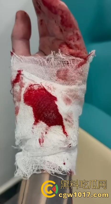 妙瓦底顺达园区缅甸KUN武装屠杀中国人!抢劫、轮奸、枪杀地盘之争,诈骗人员沦落为牺牲品,这时候你是中国人啦!-14