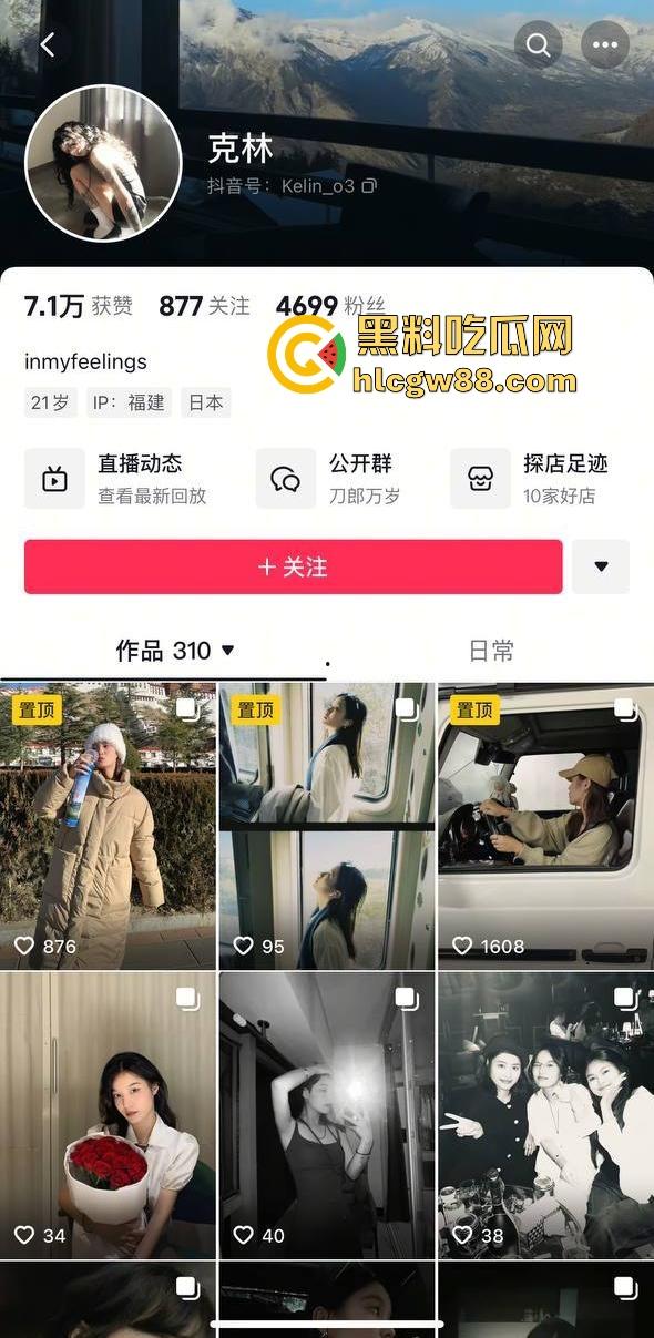 抖音厦门母狗【黄淮北】到处约炮聊骚居家狂热自慰 出去约炮时胸口的挂坠被实锤本人无疑！-1